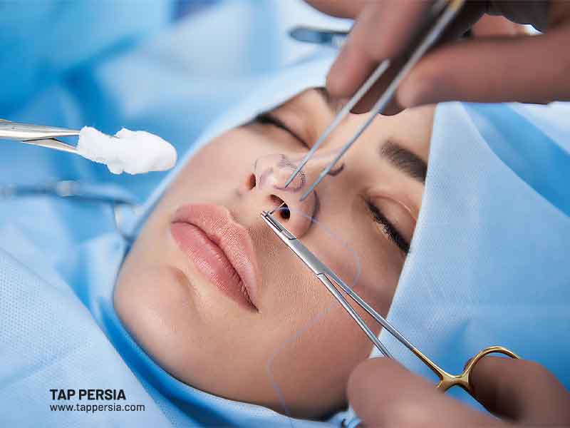 Rhinoplasty in Turkey vs. Iran